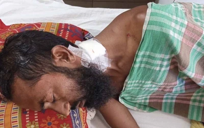 মামলায় সাক্ষী হওয়ায় মহিপুরে যুবককে কুপিয়ে জখম